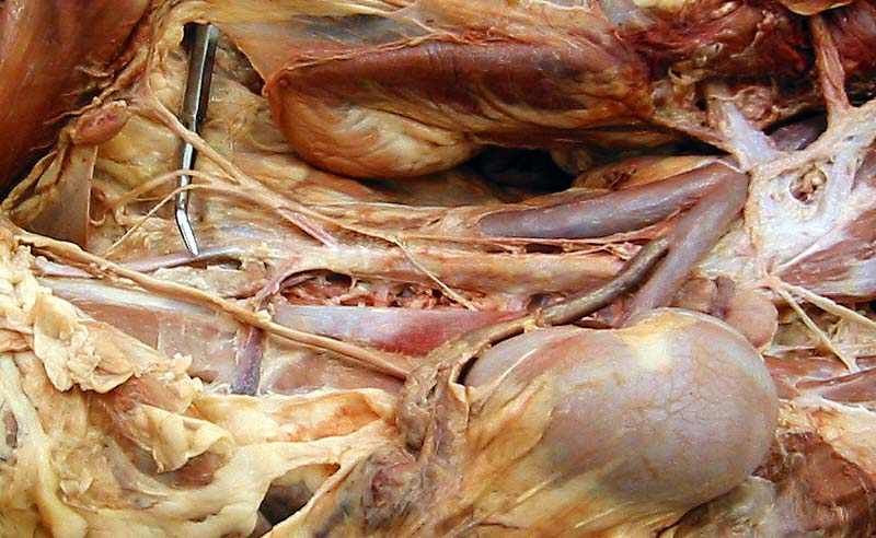 Caudal Mesenteric Ganglion - Hypogastric Nerves