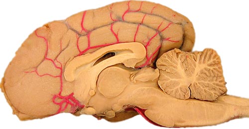 Brain Transection Levels