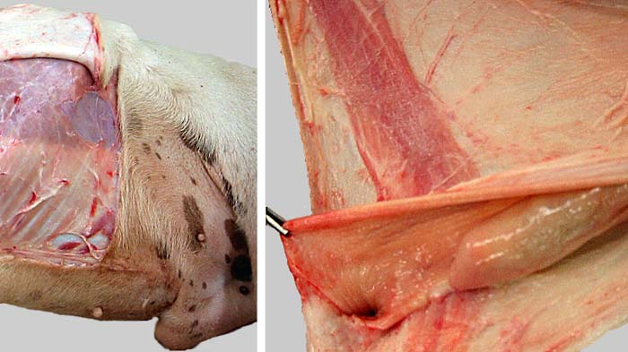 cadaver image
