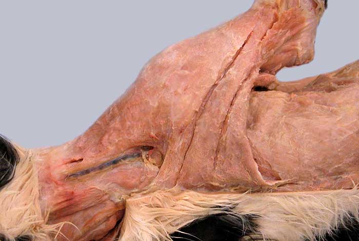 cadaver image