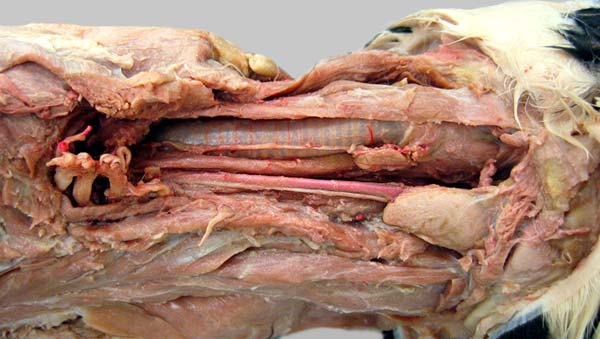 cadaver image