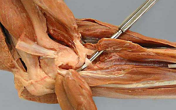 cadaver image