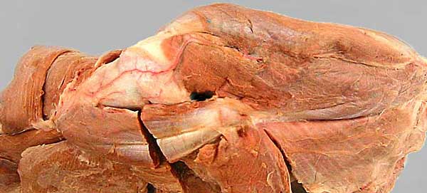 cadaver image