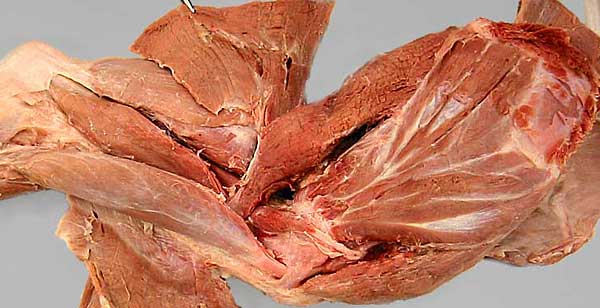cadaver image