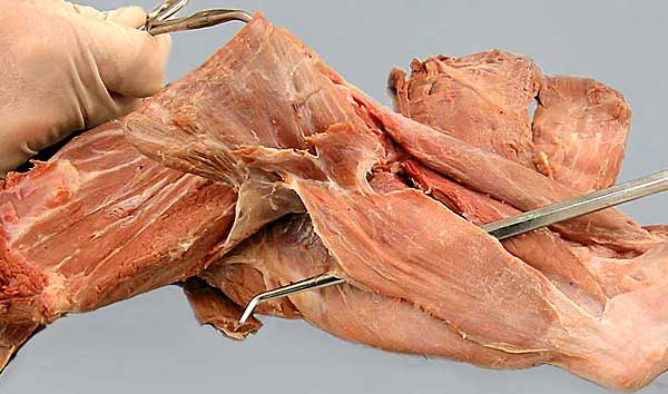 cadaver image