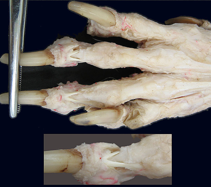 cadaver image