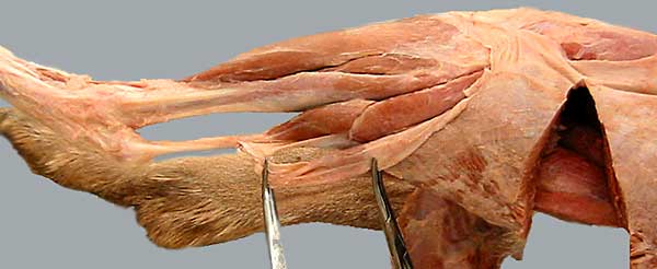 cadaver image