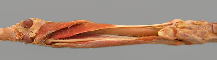 cadaver image