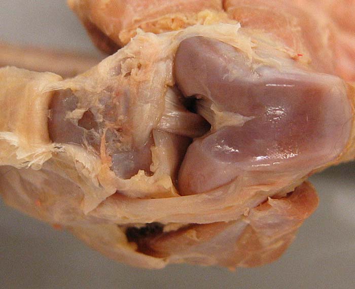 cadaver image