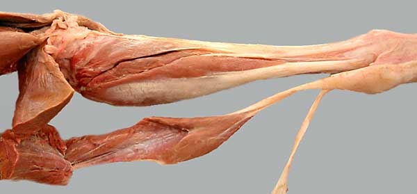 cadaver image