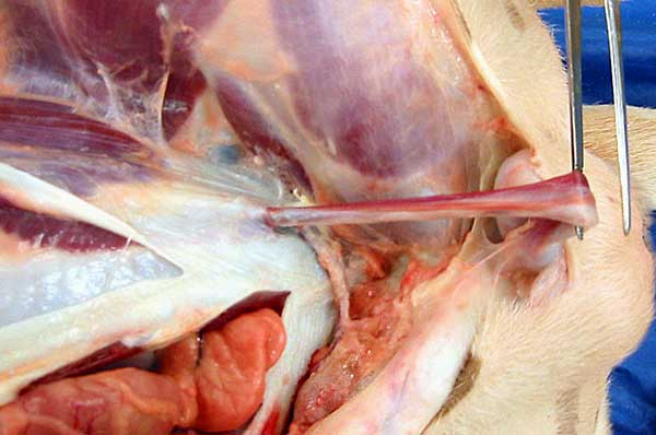 cadaver image