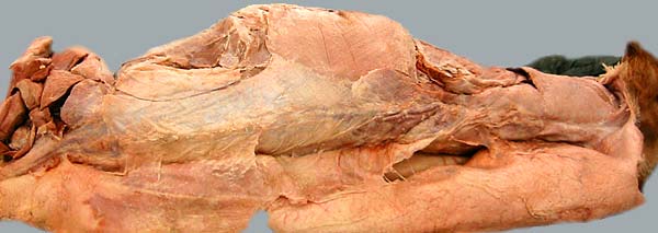 cadaver image