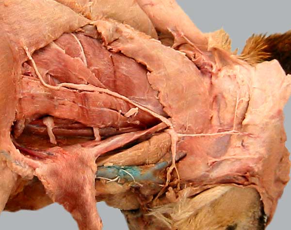 cadaver image