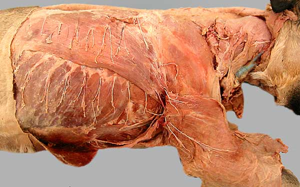 cadaver image