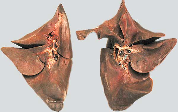cadaver image