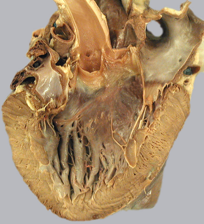 cadaver image
