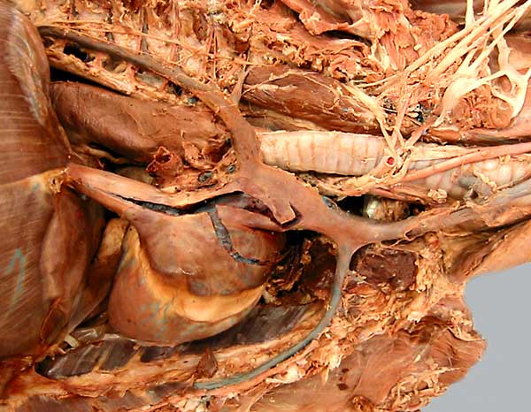 cadaver image