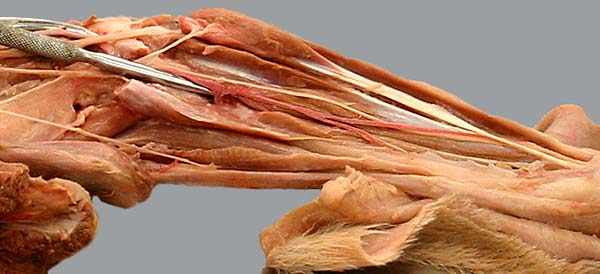 cadaver image