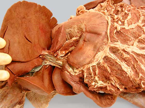 cadaver image