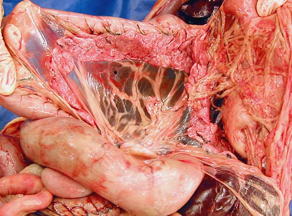 cadaver image