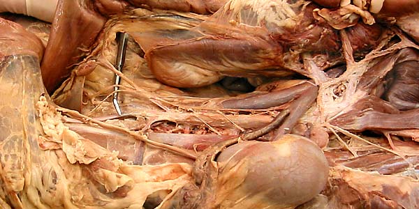 cadaver image