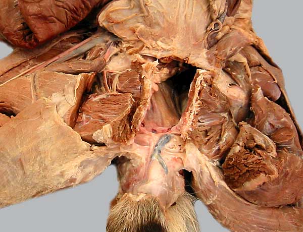 cadaver image