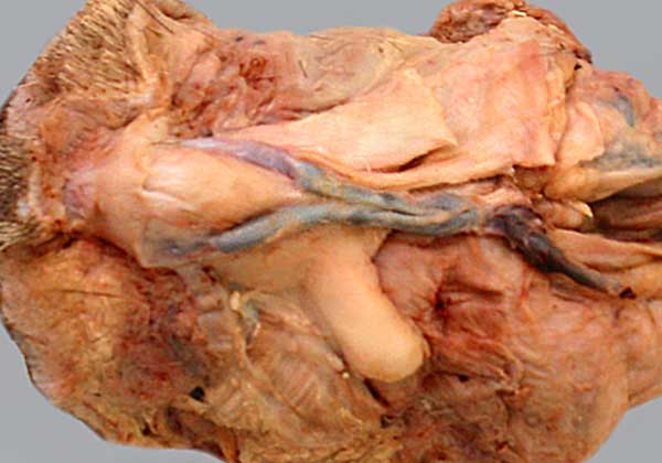 cadaver image