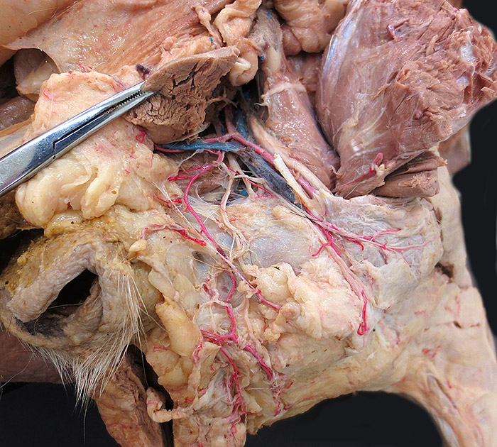 cadaver image