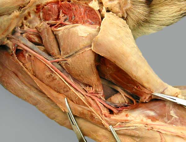 cadaver image