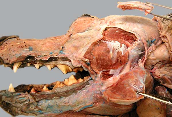cadaver image