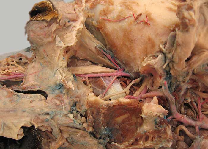 cadaver image