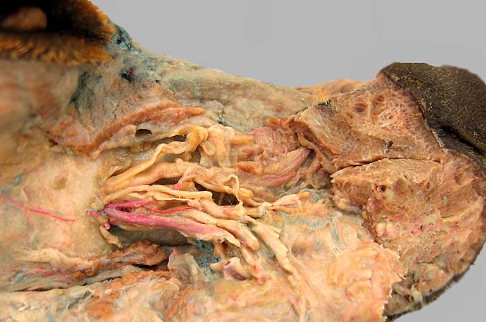 cadaver image