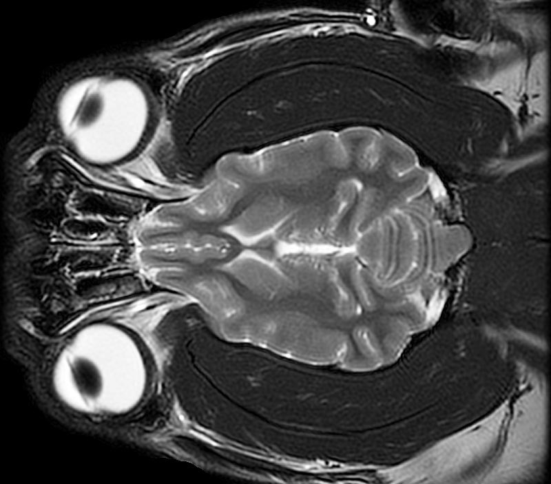 Dorsal Plane MRI Head Atlass