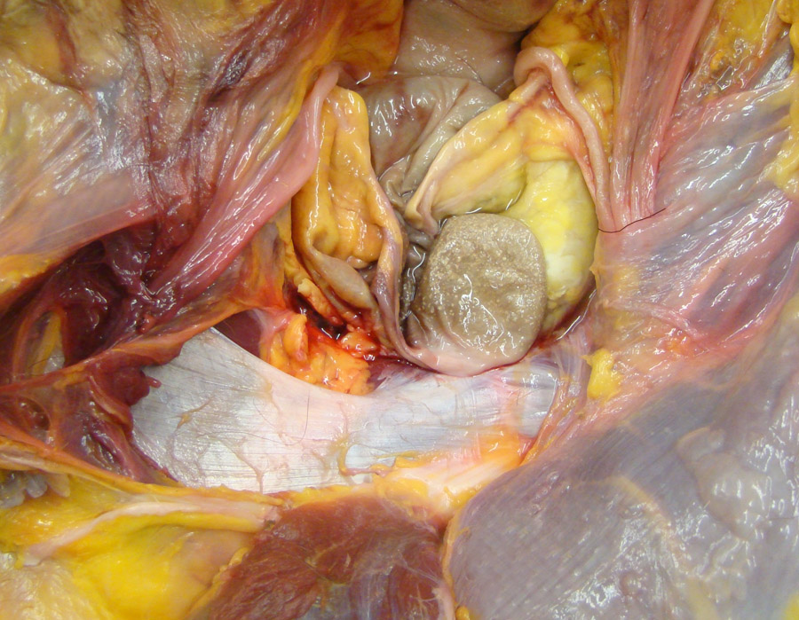 cadaver image