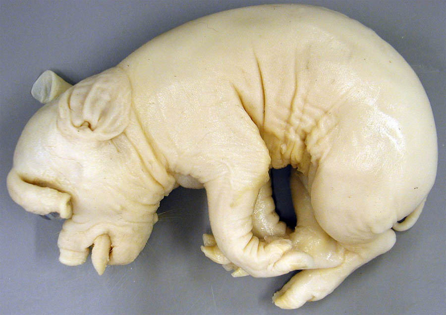 cadaver imag