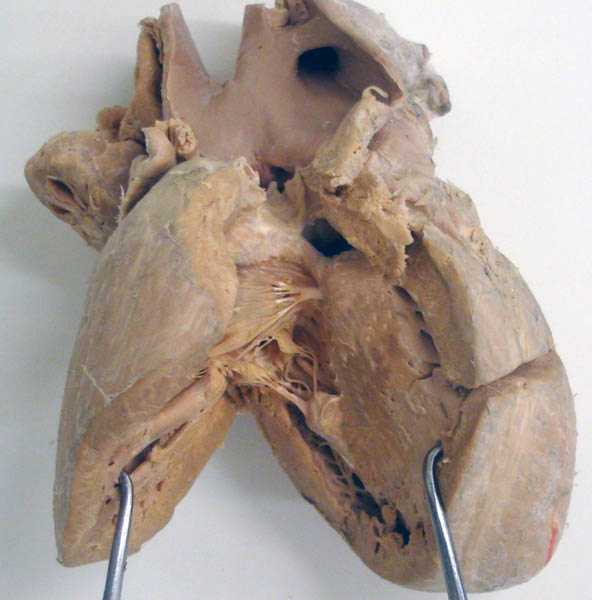 cadaver imag