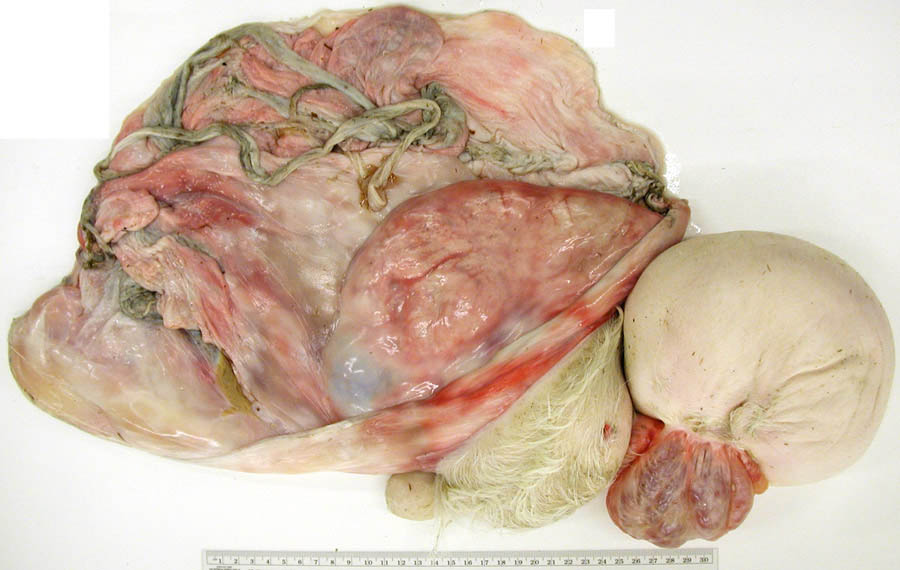 cadaver imag