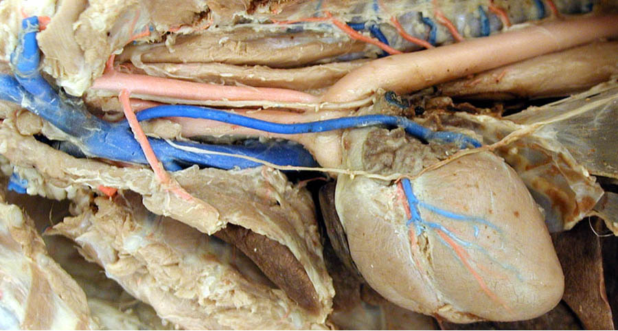 cadaver imag