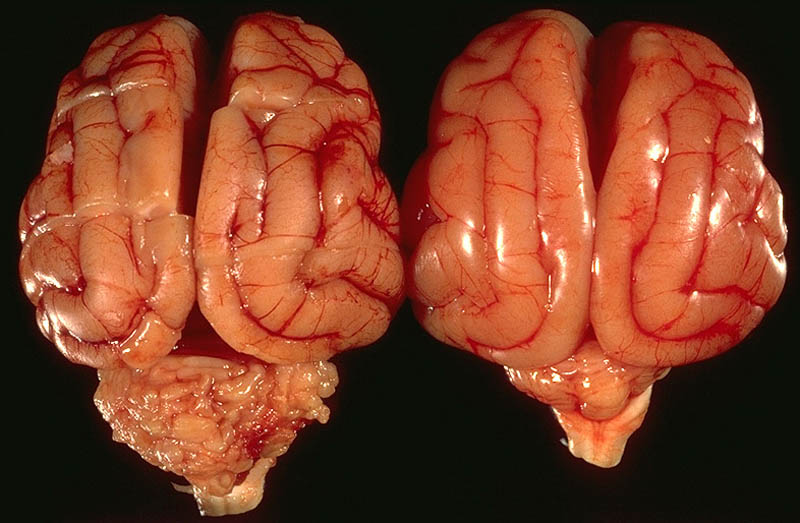 cadaver imag