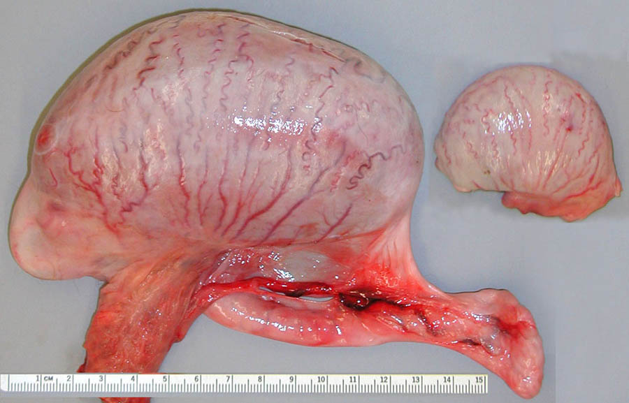 cadaver imag