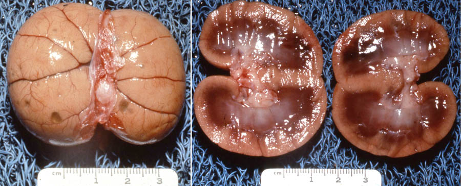 cadaver imag