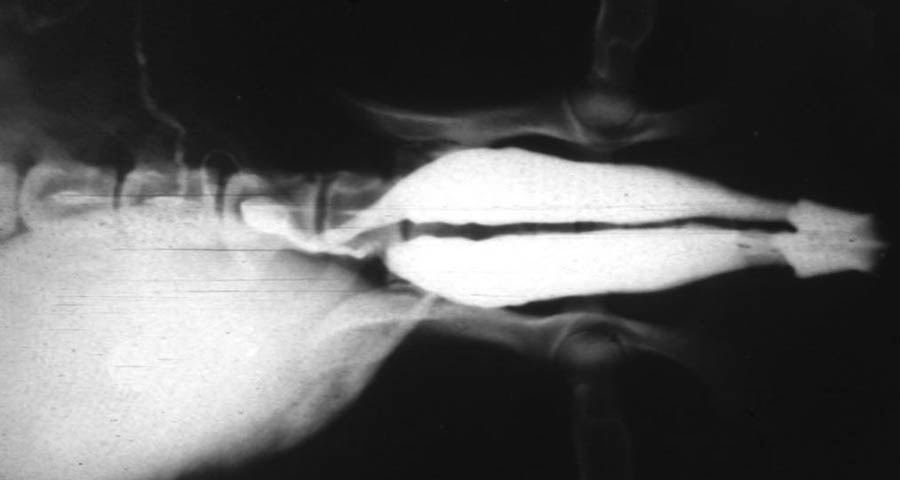 cadaver imag